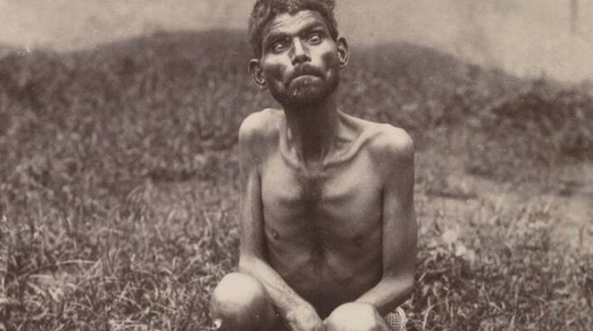 6 yaşına kadar kurtlar tarafından büyütüldü! Yaşamı Disney filmlerine konu olan adam: Dina Sanichar