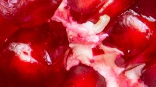 Narın faydaları yalnızca tanelerinde değil: Kabuğu bile şifa kaynağı çıktı!