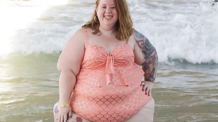 Sosyal medyada hastalığıyla savaşını anlatıyor! Cara Cruz eleştirilere rağmen güzellik tabularını yıkıyor 