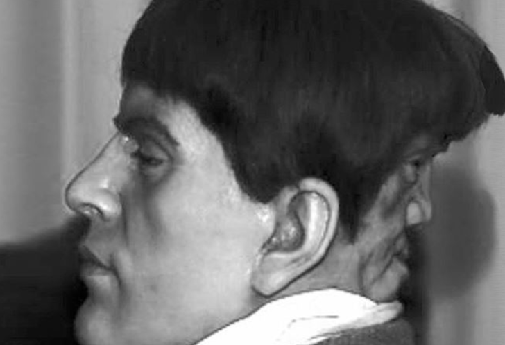 Kafasının arkasında başka bir yüzle doğan ve fısıltılar nedeniyle delirdiği söylenen bir adam: Edward Mordake