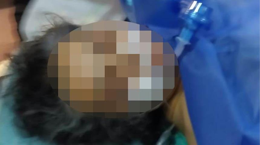 Gözü dönmüş saldırgan kan dondurdu! 500 lira nafaka isteyen eşini 12 yerinden bıçakladı