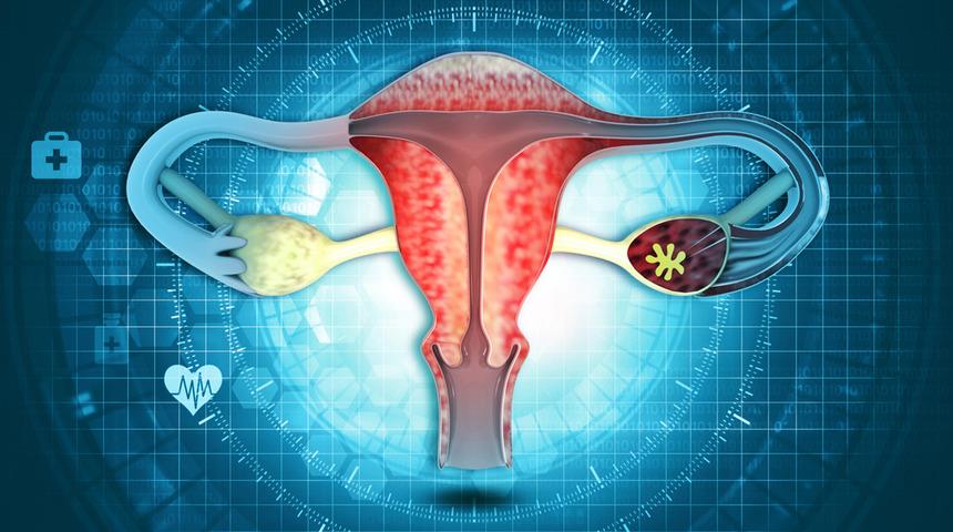 Miyom belirtileri nelerdir? Sessizce ilerliyor, kısırlığa bile sebep oluyor