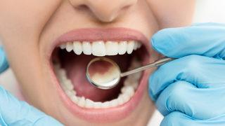 Bu besinler diş gelişimine iyi geliyor!