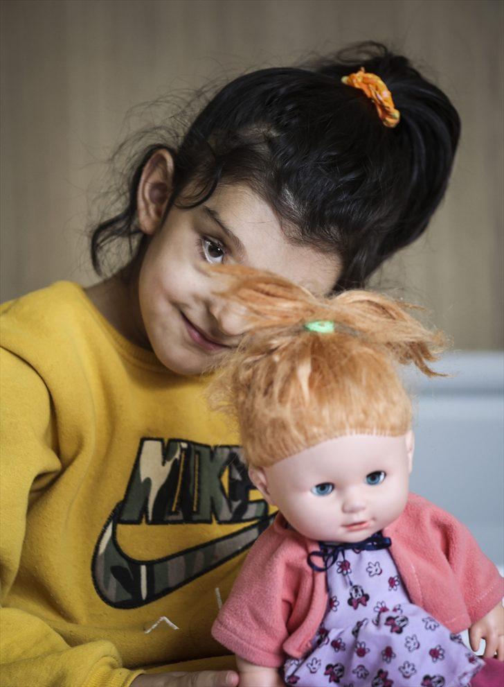 Minik Ayşenur'un normalden daha ayrık olan gözleri ameliyatla yaklaştırıldı G4