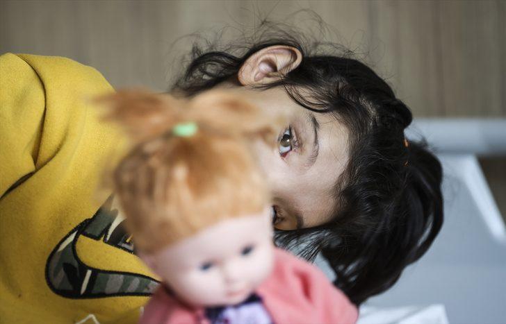 Minik Ayşenur'un normalden daha ayrık olan gözleri ameliyatla yaklaştırıldı G5