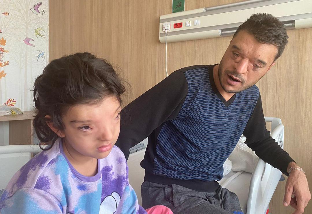 D&uuml;nyada sadece 4 ailede g&ouml;r&uuml;l&uuml;yordu! G&ouml;zleri arasındaki mesafe 3 santimetreye d&uuml;ş&uuml;r&uuml;ld&uuml;