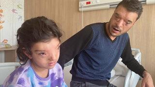 Dünyada sadece 4 ailede görülüyordu! Gözleri arasındaki mesafe 3 santimetreye düşürüldü