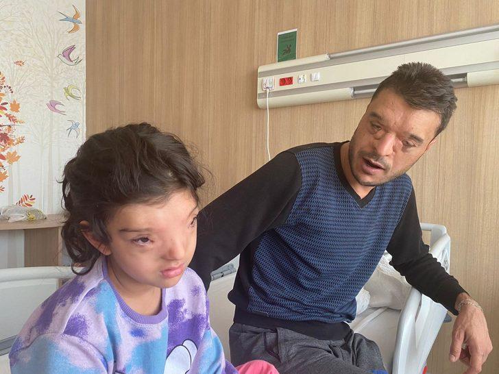 Dünyada sadece 4 ailede görülüyordu! Gözleri arasındaki mesafe 3 santimetreye düşürüldü G5