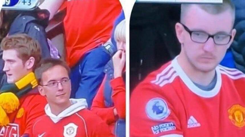 Saçları döküldüğü için Manchester United'a dava açıyor