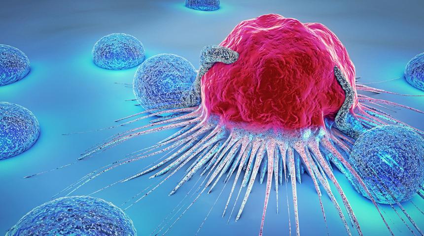 Kemik tümörü belirtileri ve tedavisi nedir? Geçmeyen kemik ağrıları kemik tümörü belirtisi olabilir!