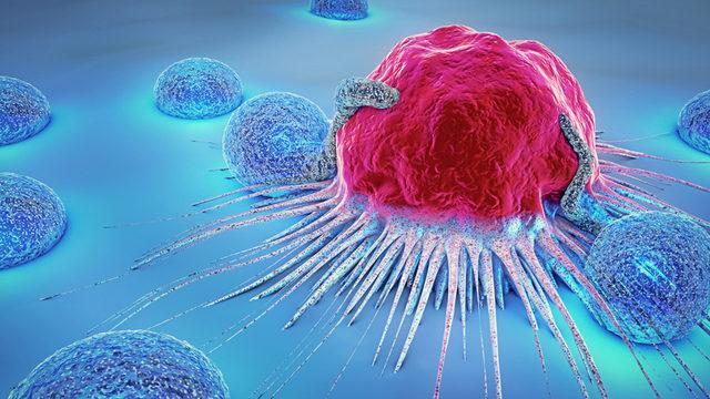 Kemik tümörü belirtileri ve tedavisi nedir? Geçmeyen kemik ağrıları kemik tümörü belirtisi olabilir!