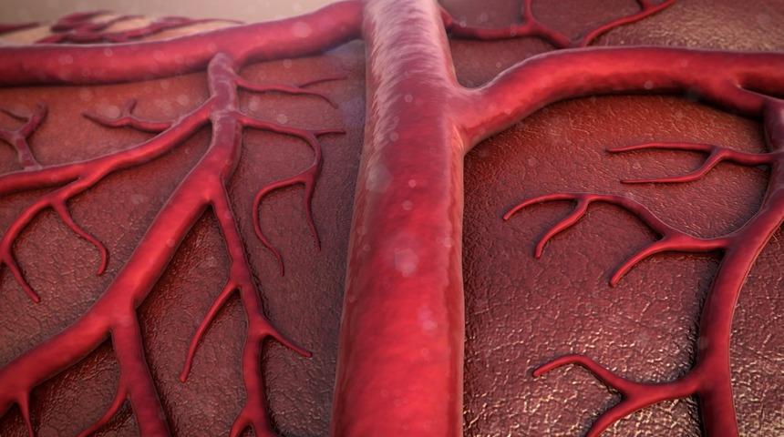 Damar sertliği kanserden daha fazla can alıyor
