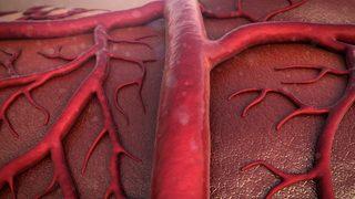 Damar sertliği kanserden daha fazla can alıyor