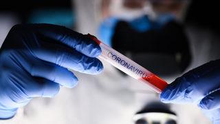 Veriler inceleniyor! Dikkat çeken açıklama: Covid-19 sonrası hem kadınlarda hem erkeklerde idrar kaçırma rahatsızlıkları arttı