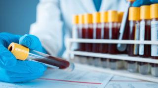 Kanser teşhisi için kan testi geliştirildi! 50'den fazla kanseri tespit ediyor