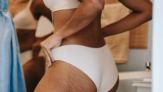 Selülit ve çatlaklardan kurtulmak mümkün! Bu yöntemleri uygularsanız...