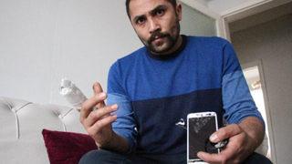 Patlayan powerbank parmağını kopardı: Lisanslı ürün aldım ama havan topu gibi patladı