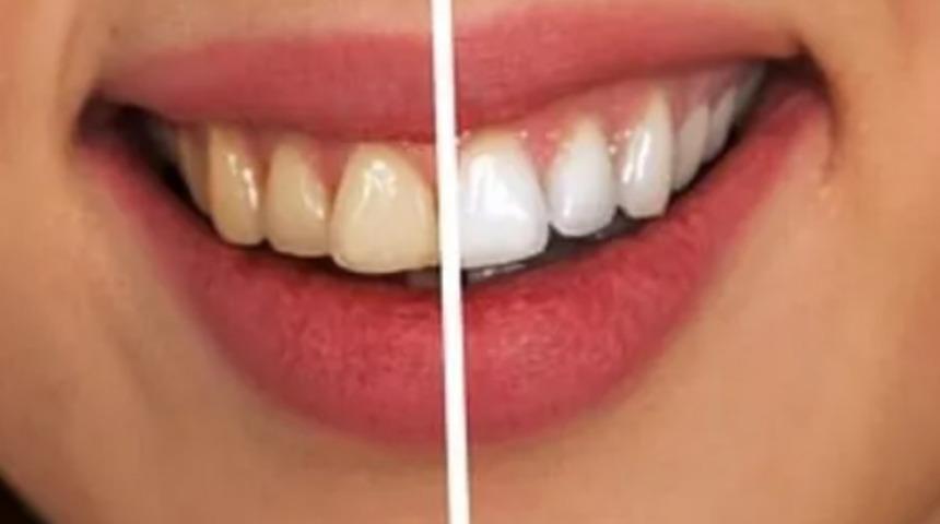 Aman bunları ihmal etmeyin! Bembeyaz dişler ve sağlıklı bir ağız florası için neler yapmalı?
