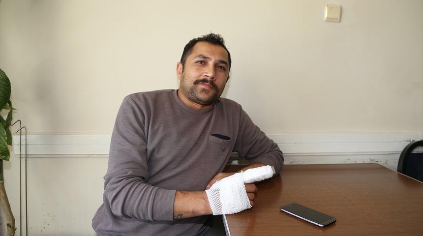 Şarj cihazının patlamasıyla parmağı kopan Erzurumlu hasta yaşadığı korkuyu unutamıyor