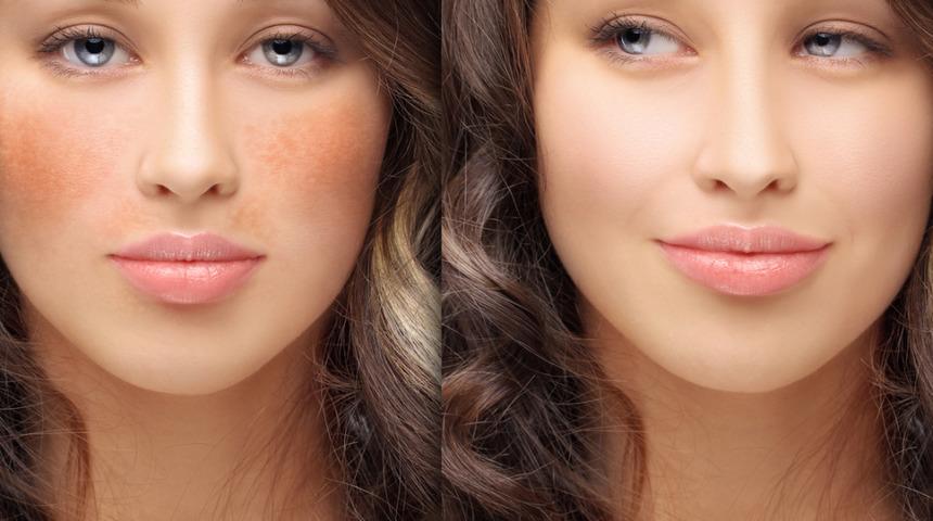 Kusursuz cilt görünümü hepimizin hakkı! Cilt üzerindeki yoğun lekeleri kapatmak için tüyolar