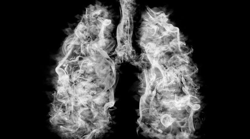 Sigaradan her yıl 114 bin kişi ölüyor