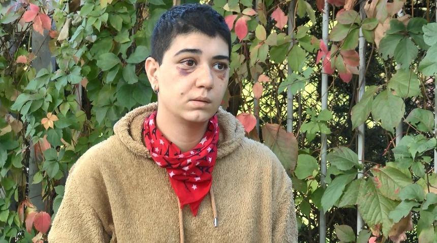 Beyoğlu'nda kadına felç eden dayak! Sebebi pes dedirtti