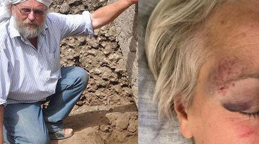 Göbeklitepe'yi keşfeden Klaus Schmidt'in eşi Çiğdem Köksal Schmidt Şanlıurfa'da saldırıya uğradı