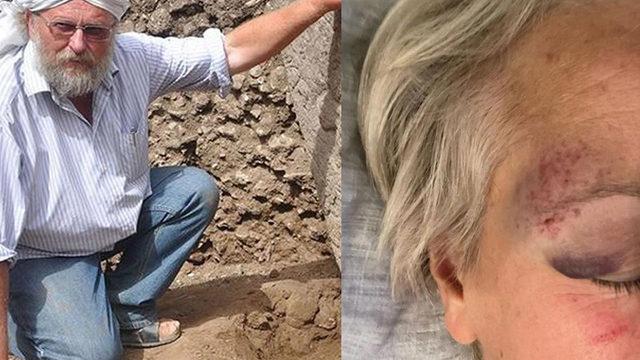Göbeklitepe'yi keşfeden Klaus Schmidt'in eşi Çiğdem Köksal Schmidt Şanlıurfa'da saldırıya uğradı