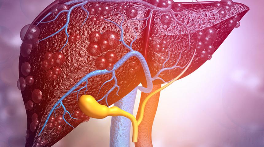 Karaciğer yetmezliği tedavisinde organ nakli hayat kurtarıyor