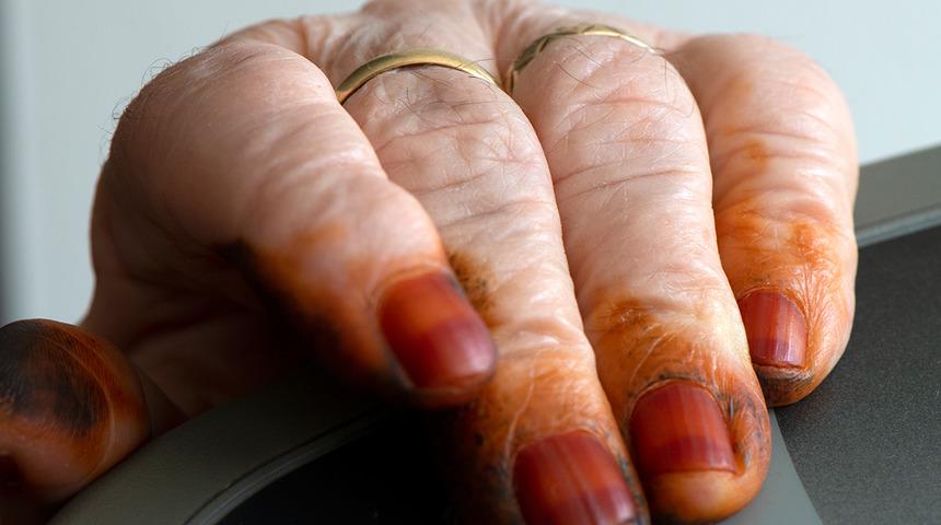 G&uuml;ld&uuml;ren yardım talebi