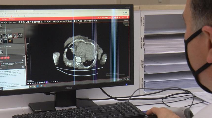 Ödüllü araştırma ilk kez ortaya çıkardı: Koronavirüs kalp hastalıkları ve kanserden koruyan sistemin 'şalterlerini' kapatıyor