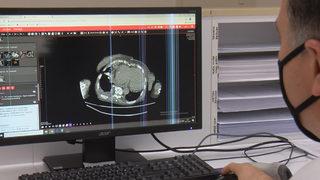 Ödüllü araştırma ilk kez ortaya çıkardı: Koronavirüs kalp hastalıkları ve kanserden koruyan sistemin 'şalterlerini' kapatıyor