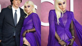 Lady Gaga bile isteye gösterdi! Eteğini sıyırıp açtı