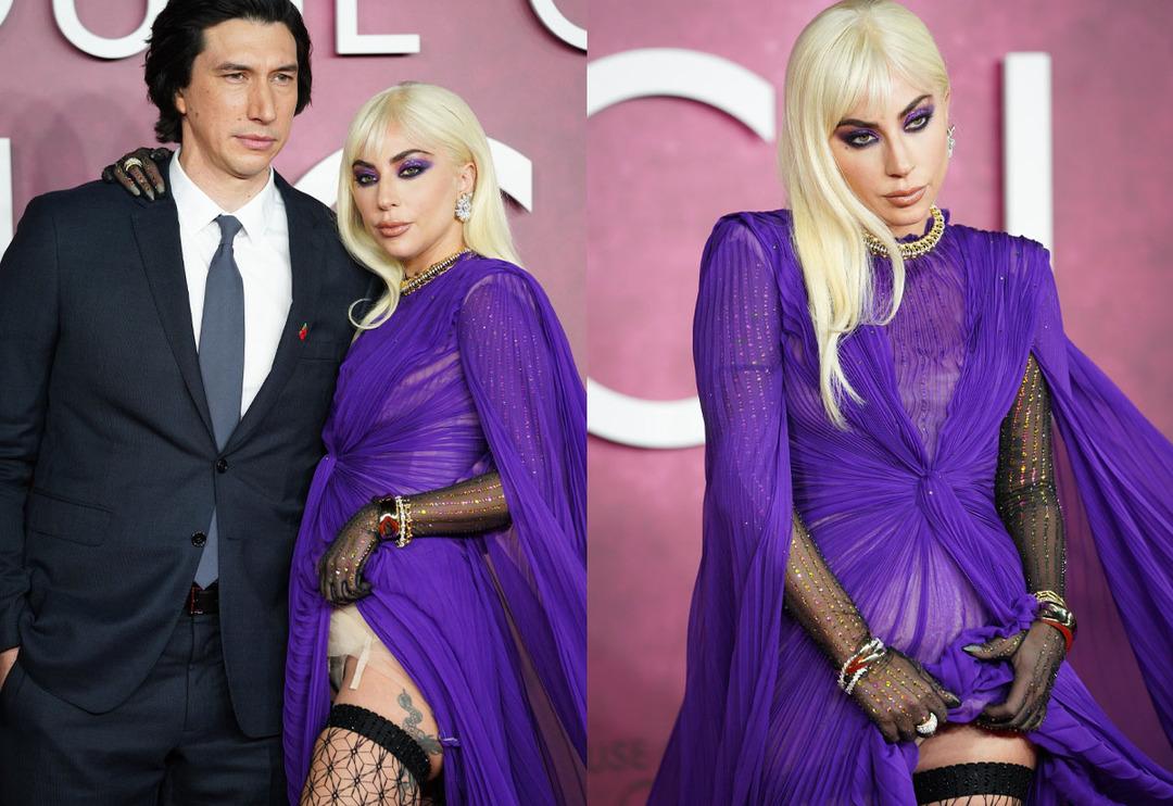 Lady Gaga bile isteye g&ouml;sterdi! Eteğini sıyırıp a&ccedil;tı