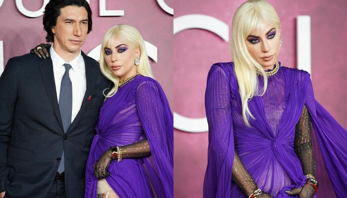 Lady Gaga bile isteye gösterdi! Eteğini sıyırıp açtı