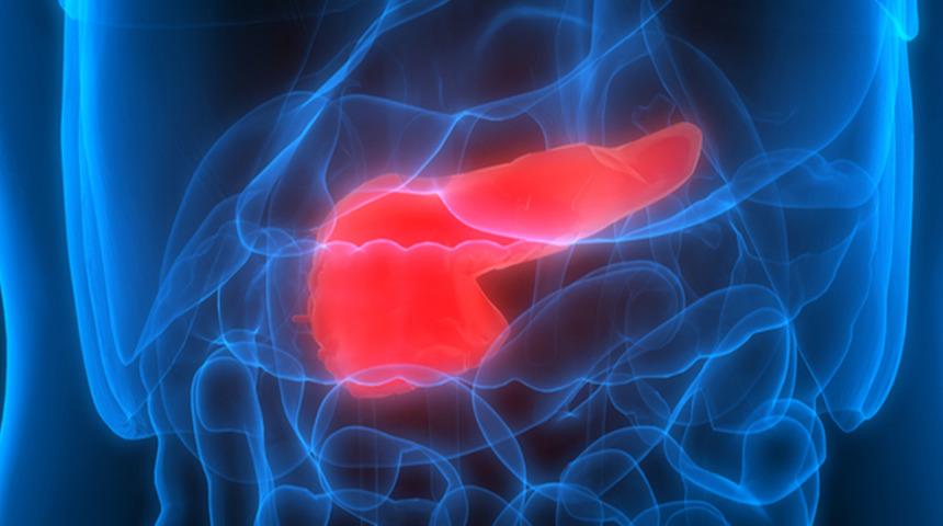 Pankreas kanseri belirti vermeden sinsice ilerliyor! Tedavi için ameliyat gerekli mi?