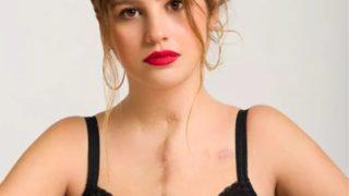 Kalp naklinden sonra yaşadığı tuhaf yan etkileri anlatan genç kız sosyal medyada popüler oldu