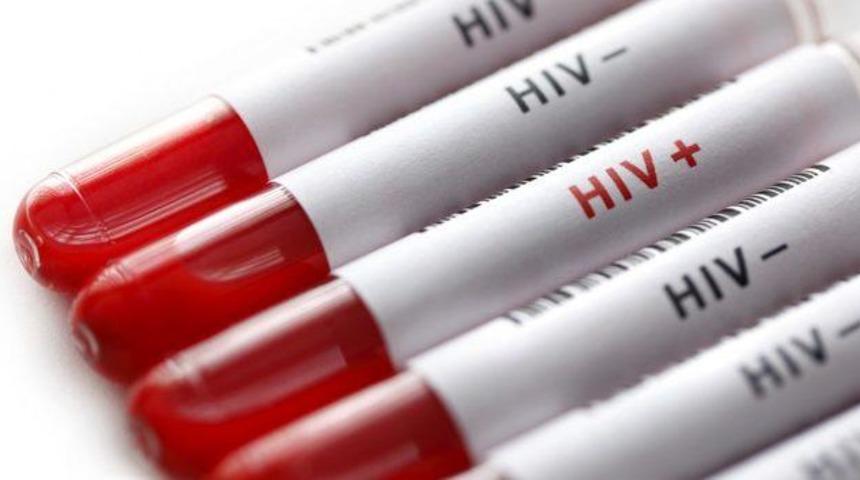Dünyada 17.6 milyon AIDS'li kadın bulunuyor      