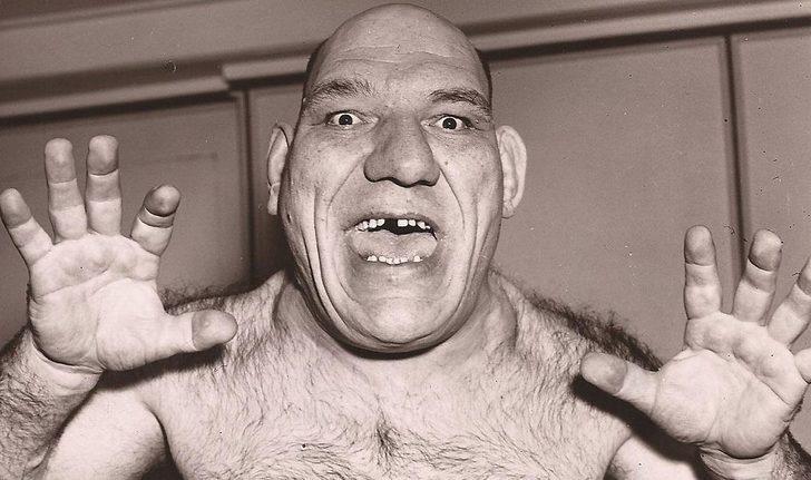 2 cinsel organı 3 bacağı olan şovmen! İşte tarihin en ilginç 5 insanı G3