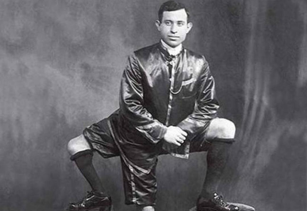 2 cinsel organı 3 bacağı olan şovmen! İşte tarihin en ilgin&ccedil; 5 insanı