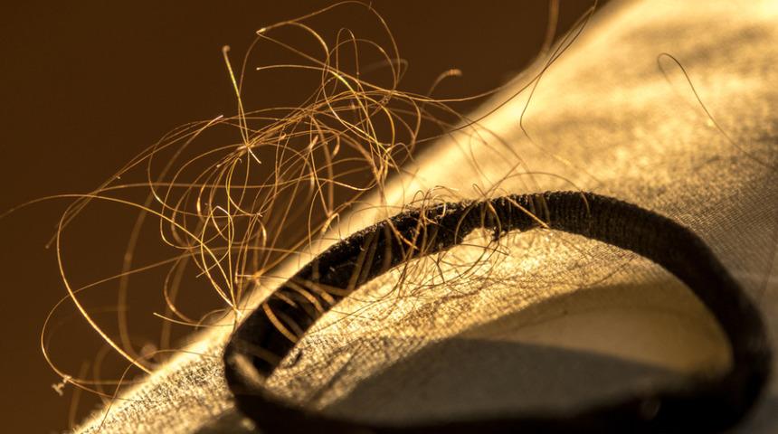 Saç dökülmelerine dur deyin! Saç derisini besleyerek dökülmeyi azaltan tamamen doğal tarifler