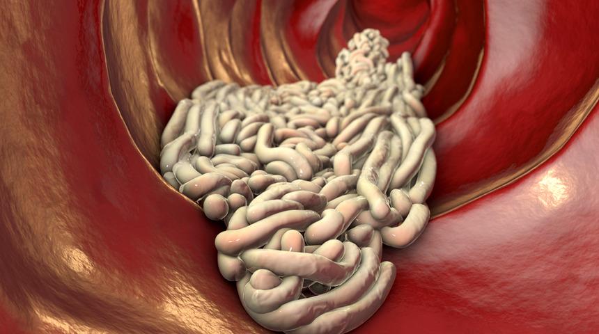 İplik solucanları ile pankreas kanserini teşhis ettiler! Pankreas kanseri tedavisi için umut verdi