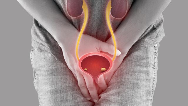 Mesane kanseri belirtileri nasıl anlaşılır? Kaburga ve üst baldırda sertleşme varsa...