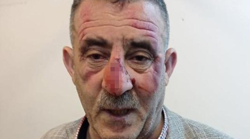 Randevusuz alınmayacağını öğrenince elindeki cisimle sağlık çalışanına saldırdı! 