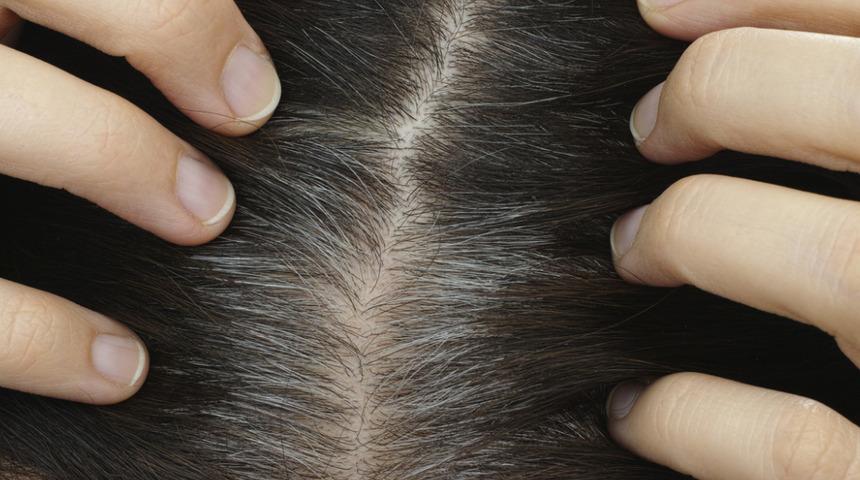 "Sa&ccedil;larım mat ve yıpranmış" diye &uuml;z&uuml;lmeyin! Boyalı sa&ccedil;ları canlı ve parlak hale getirmenin yolları