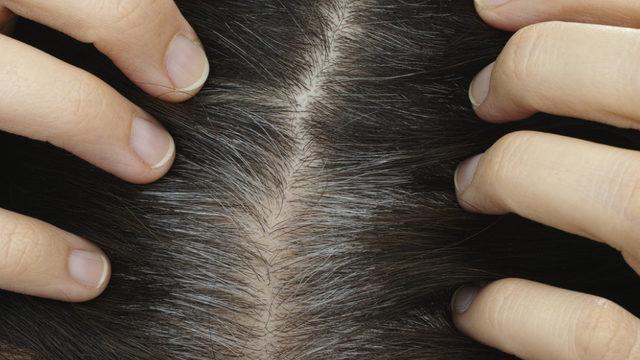 Saçlarım mat ve yıpranmış diye üzülmeyin! Boyalı saçları canlı ve parlak hale getirmenin yolları