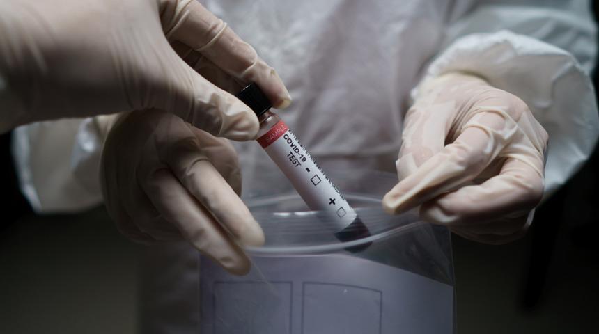 Prof. Dr. Özkaya: Maalesef virüs artık hasta seçmeye başladı, akıllı bir organizma gibi davranıyor