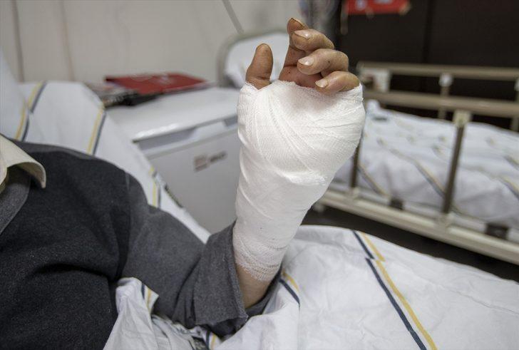 İş kazasında kopan eli doktorların zamanla yarışıyla yerine dikildi G2