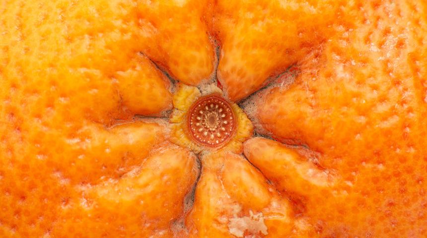 Makat çatlağı (anal fissür) evde de tedavi edilebilir! İşte yapmanız gerekenler