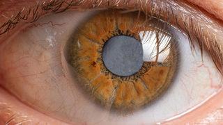 Pandemiyle artış gösteren miyopi kalıcı körlük nedeni! Günde 2 saat aydınlık havada gezin önerisi